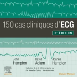 150 cas cliniques d'ECG