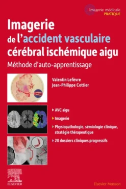 Imagerie de l'accident vasculaire cérébral ischémique aigu