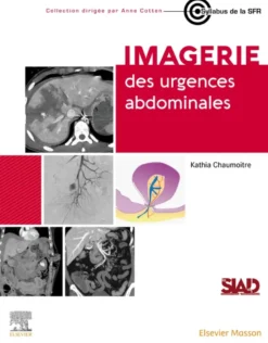 Imagerie des urgences abdominales