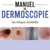 Manuel de dermoscopie