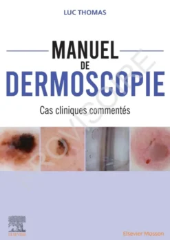 Manuel de dermoscopie